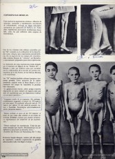 Alguns subratllats de Carrió en aquest reportatge sobre els experiments mèdics del doctor Josep Mengele, a Auschwitz. (Arxiu Comarcal del Bages. Fons Jacint Carrió i Vilaseca)